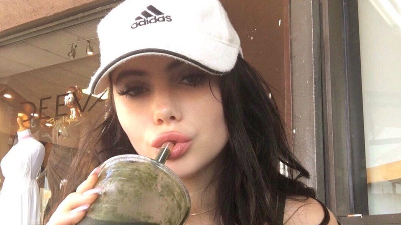 When Can I Drink From A Straw After Lip Fillers?