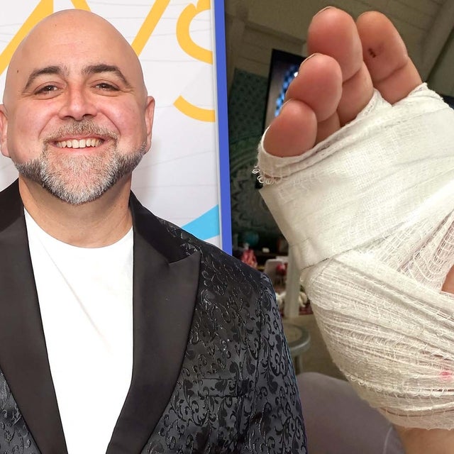 Food Network Star Duff Goldman Says a Drunk Driver Hit Him and Left Him With Injuries
