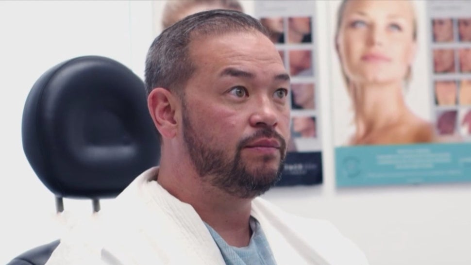 Jon Gosselin Undergoes Hair Transplant Surgery, Wants to 'Get Back in Shape' (Exclusive).jpg