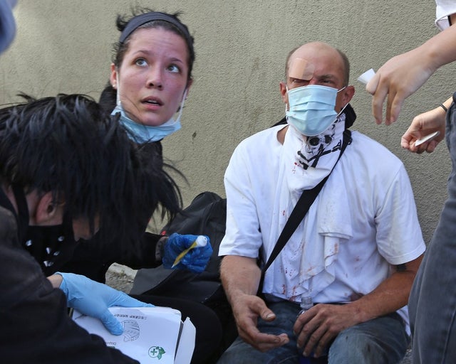halsey giving first aid to protester in santa monica
