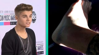Justin Bieber Broke His Foot!