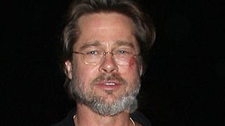 Brad Pitt Blames Face Scrape on 'Wearing Flip Flops'