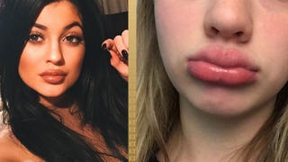 Kylie Jenner Responds To People Taking the Disturbing 'Kylie Jenner Challenge'
