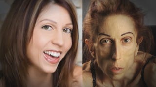 Anorexic Actress Rachael Farrokh Says No Hospital Will Help Her