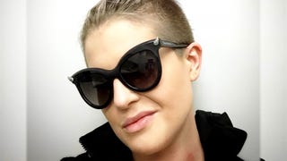 Kelly Osbourne Hospitalized After Being Bitten By Poisonous Spider -- Again!