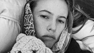 Behati Prinsloo Can't Feel Her Face After Wisdom Teeth Removal