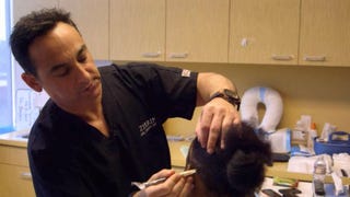 EXCLUSIVE: This Hollywood Doctor Saves Balding Celebrities: Here's How