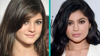 Kylie Jenner's Cosmetic Doctor Praises Star for 'Amazing Metamorphosis'