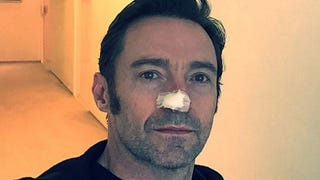 Hugh Jackman Is 'Well' After Skin Cancer Scare -- See the Photo