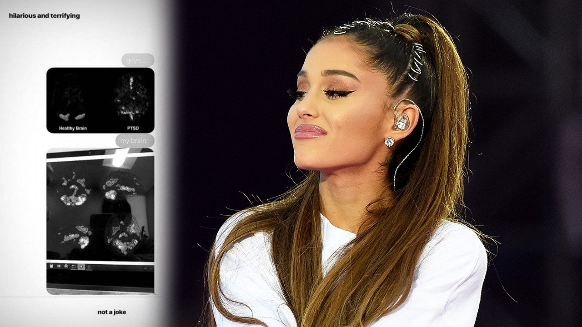 Ariana Grande Shares Her Brain Scan To Show Her Terrifying