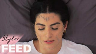 Could Facial Acupuncture Treatments Replace Botox?