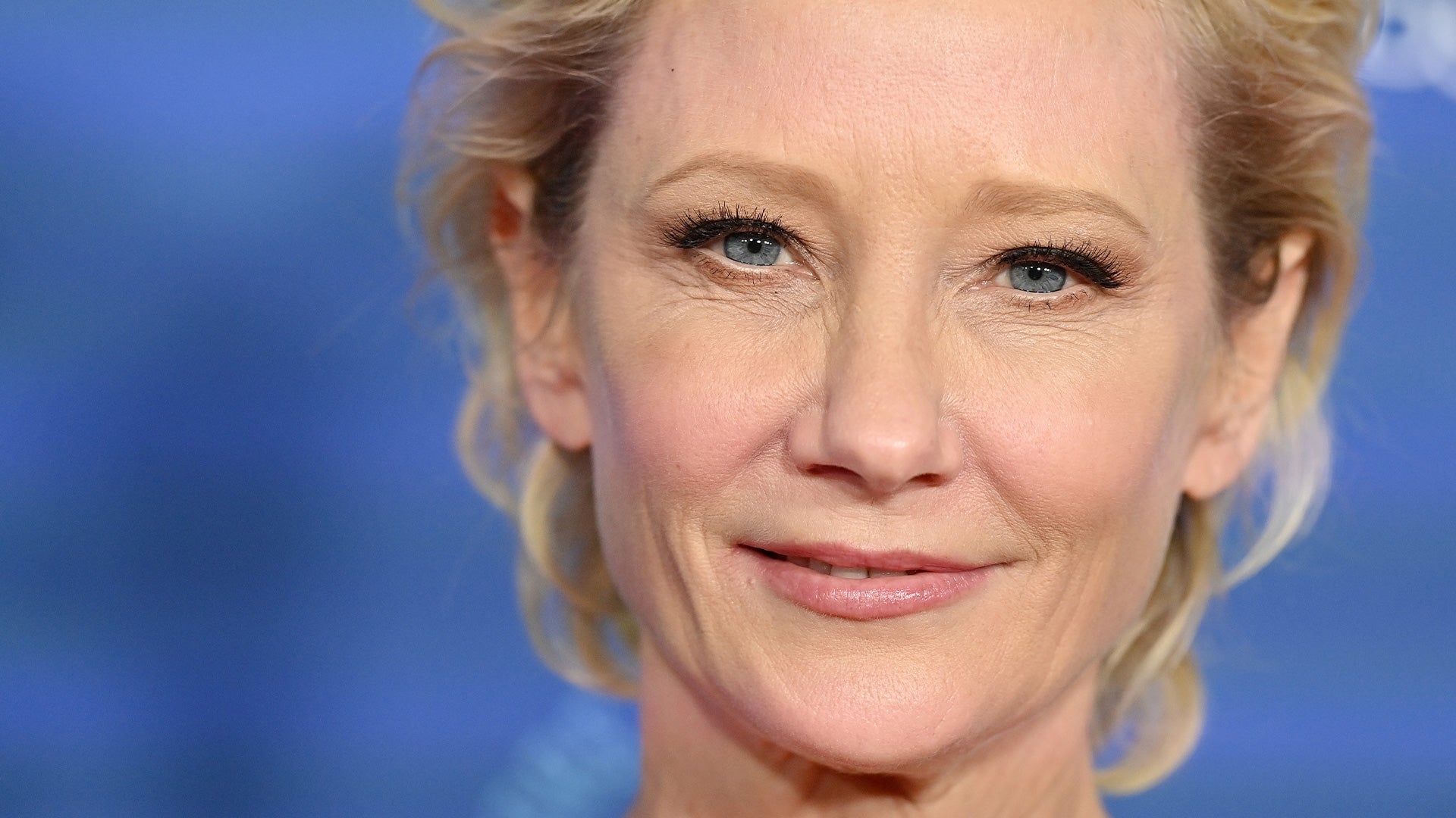 Anne Heche ‘Not Expected to Survive’ Due to Severe Brain Injury