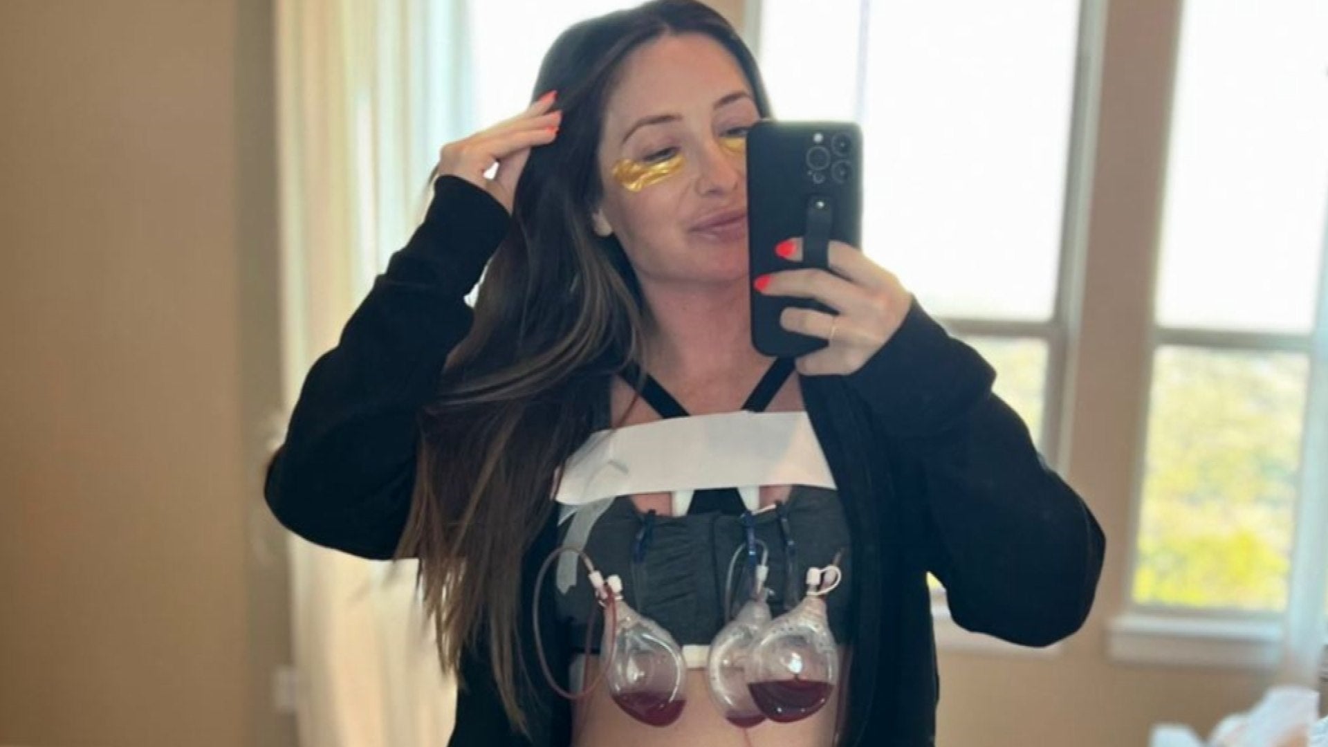 Bristol Palin Undergoes Ninth Breast Reconstruction After ‘Botched’ Reduction Surgery