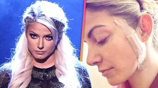 WWE Star Alexa Bliss Reveals Skin Cancer Diagnosis 