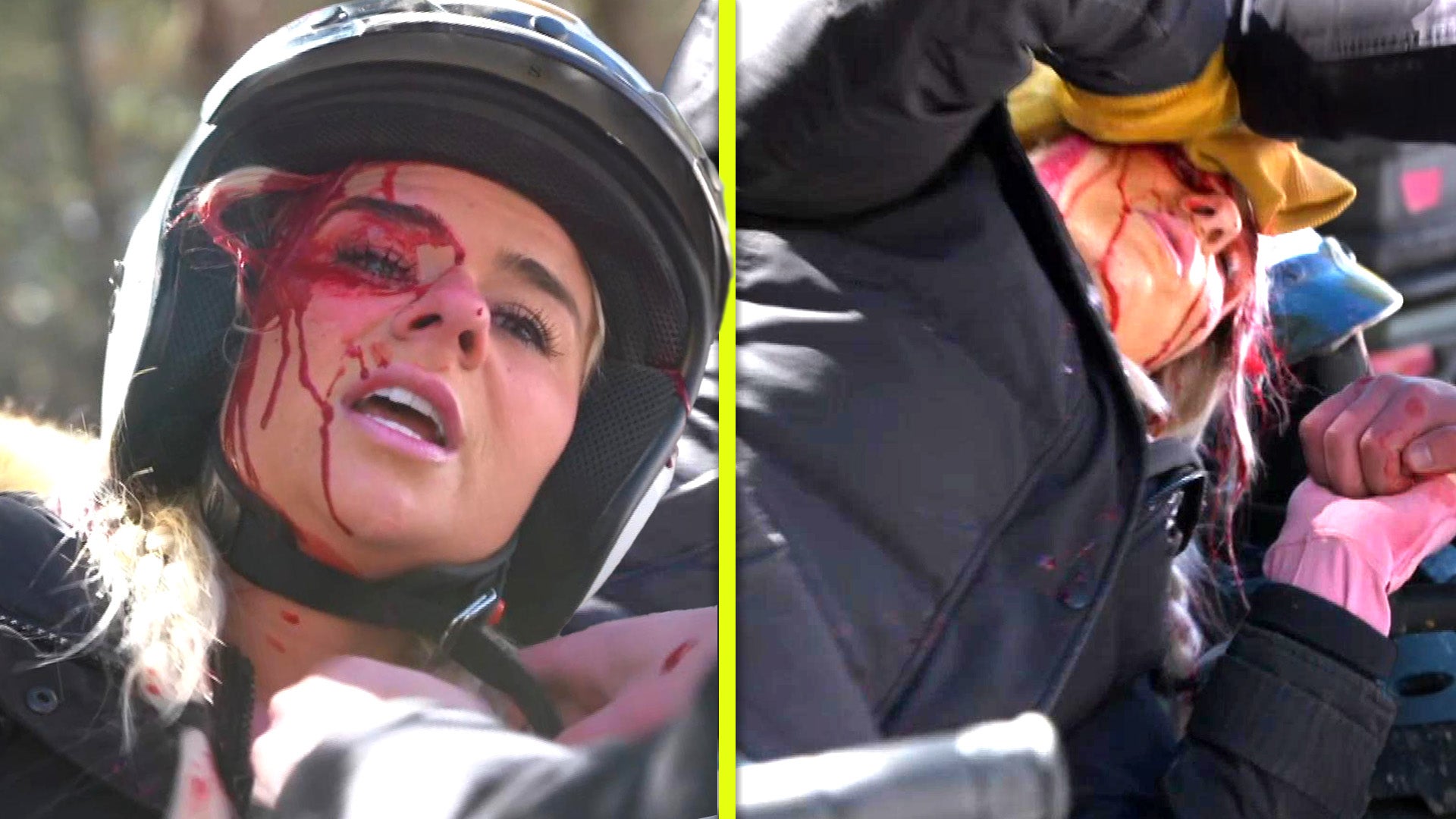 'Married at First Sight’: Emily Suffers Head Injury From Terrifying ATV Accident (Exclusive)