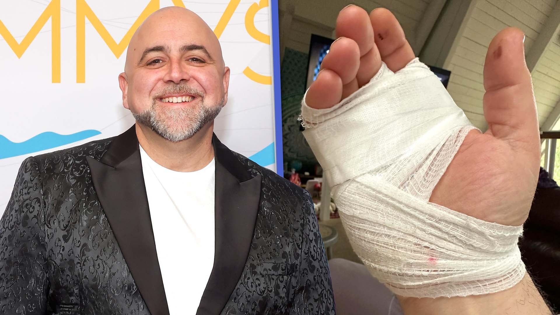 Food Network Star Duff Goldman Says a Drunk Driver Hit Him and Left Him With Injuries