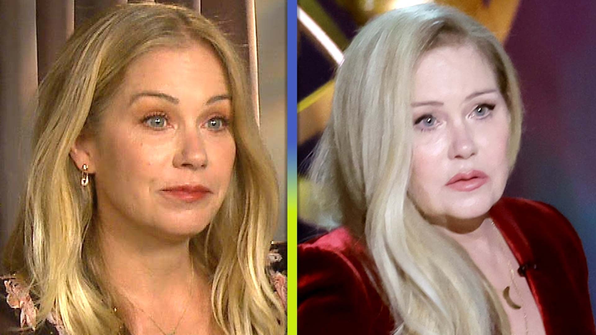 Christina Applegate Reveals She Has 30 Lesions on Her Brain Amid MS Battle
