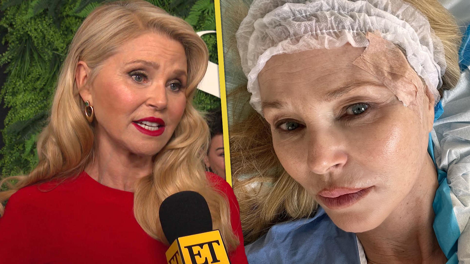 Christie Brinkley's Message to Fans Following Skin Cancer Scare (Exclusive)