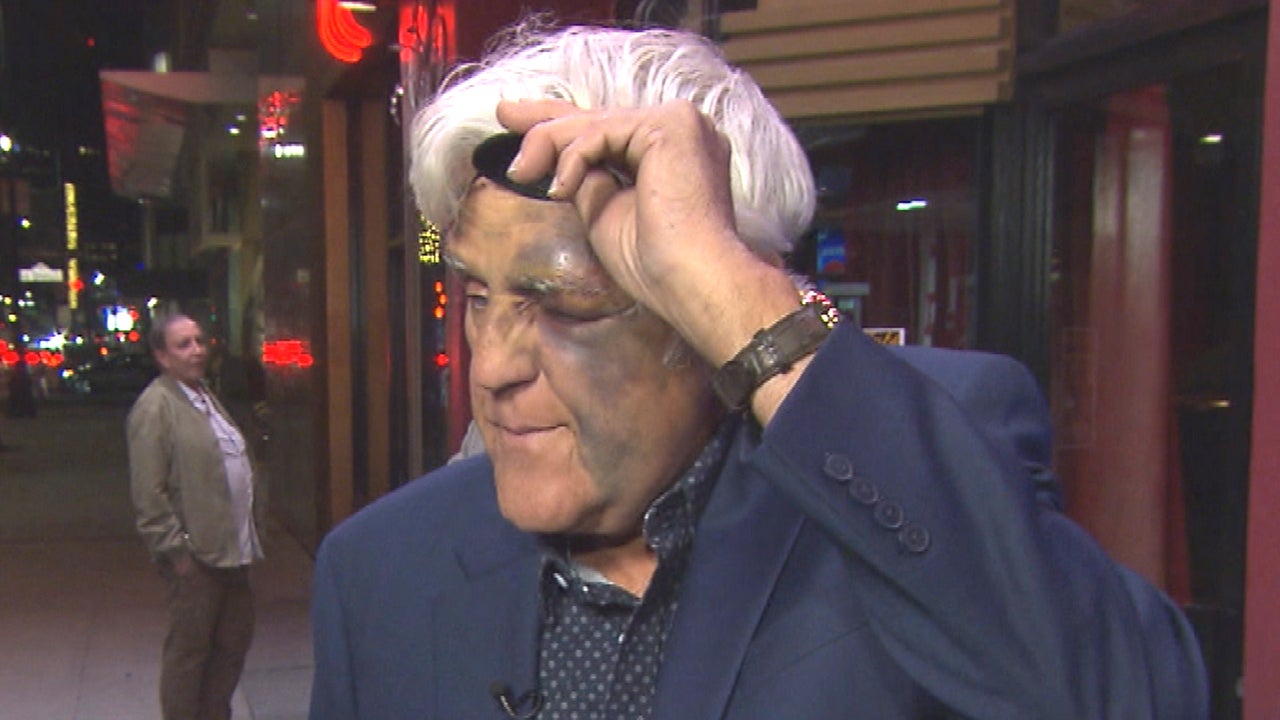 Jay Leno Seen With Badly Bruised Face, Broken Wrist and Eyepatch Following 60-Ft. Fall