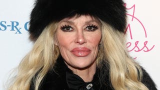 Brandi Glanville Shows Off Her New Look After Facial Disfigurement Treatments