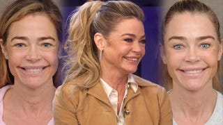 Denise Richards Shares Shocking Before and After Facelift Transformation